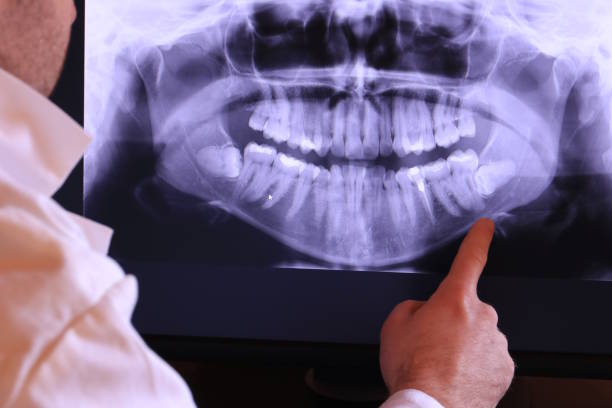 Best Emergency Gum Treatment in Chelsea, MA