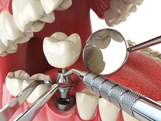 Best Emergency Denture Repair in Chelsea, MA